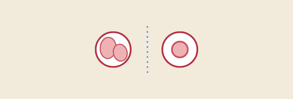 ivf twins